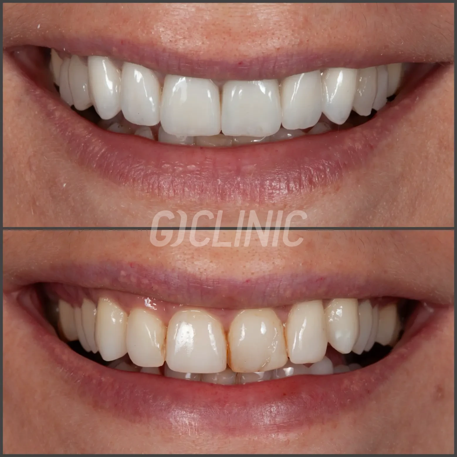 website.003 1 1