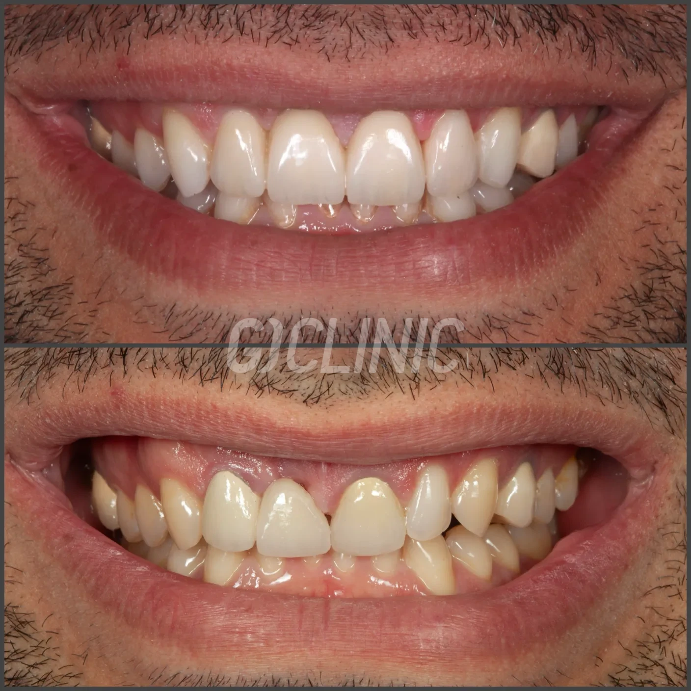 website.003 1