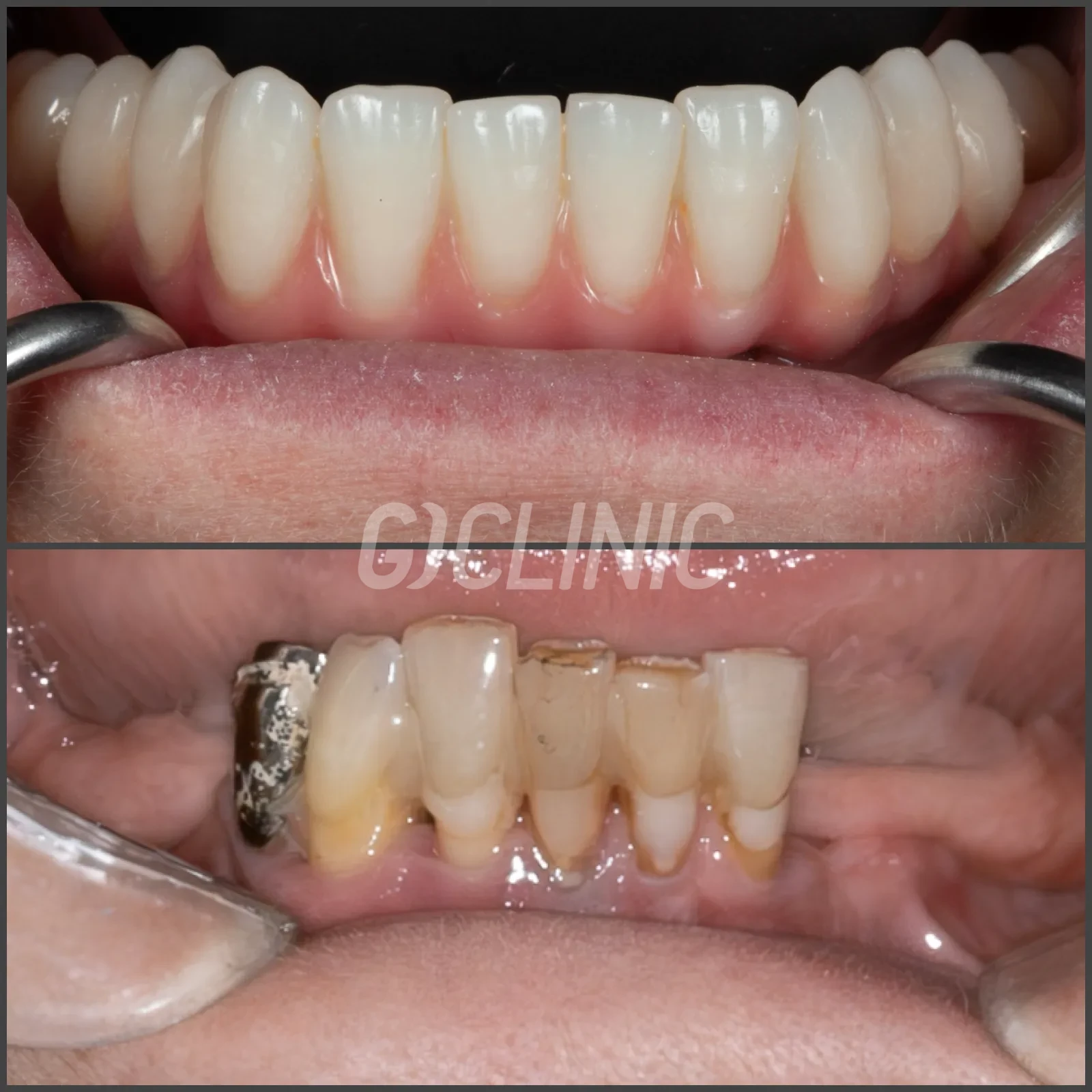website.011 1