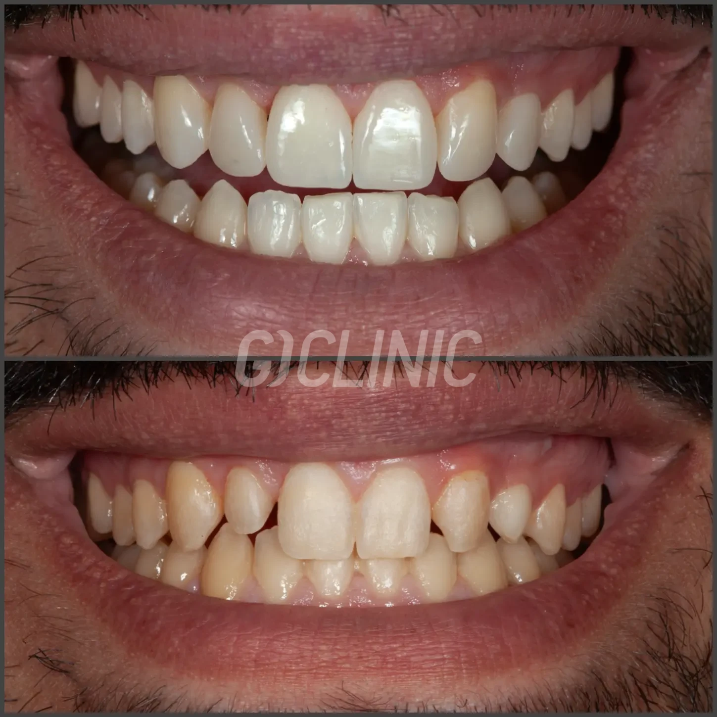 website.003 1 1